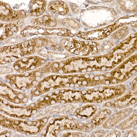 TXNDC12 Antibody (9J6L2)
