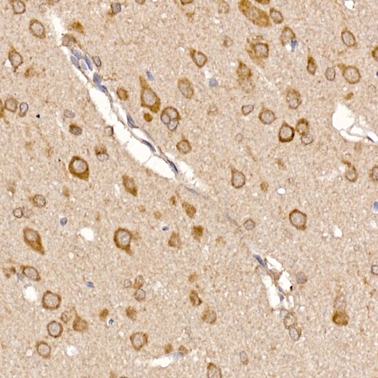 TXNDC12 Antibody (9J6L2)