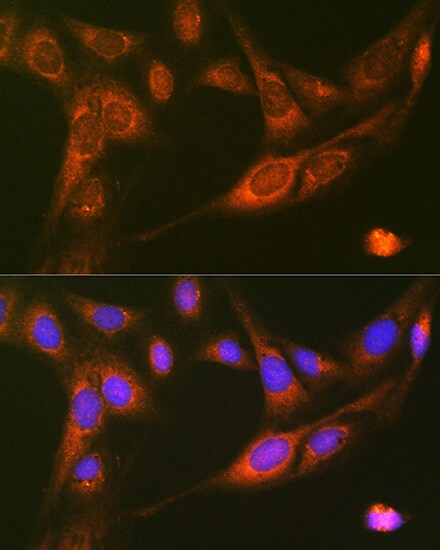 RALBP1 Antibody (5C10W9)