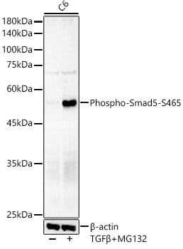 Smad5 [p Ser465] Antibody (2Q7T2)