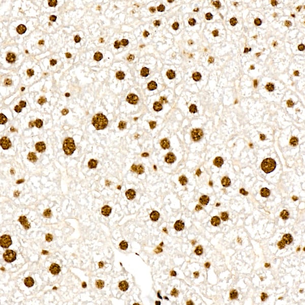 PERK [p Thr982] Antibody (0A1E6)