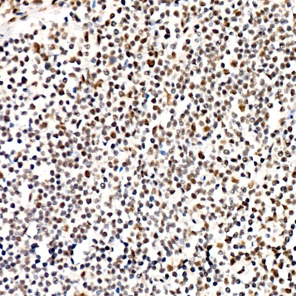 PERK [p Thr982] Antibody (0A1E6)