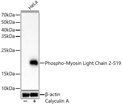 MYL9 [p Ser19] Antibody (6D8B7)