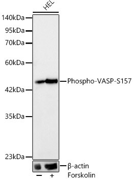 VASP [p Ser157] Antibody (2P0U3)