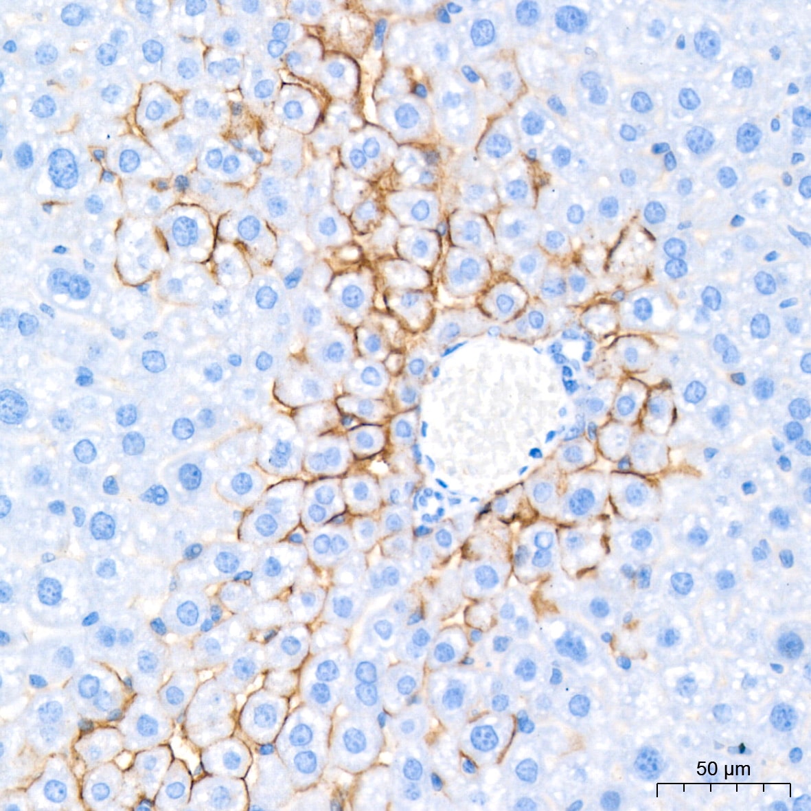 Aquaporin-4 Antibody (5A4W4)