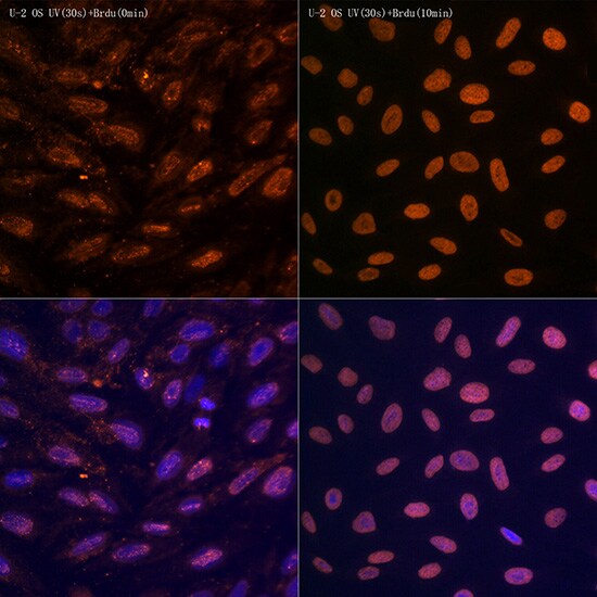 N6-methyladenosine (m6A) Antibody (6S5W2)