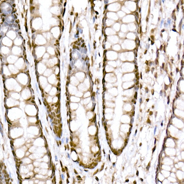PRDM9 Antibody (1H9Z1)