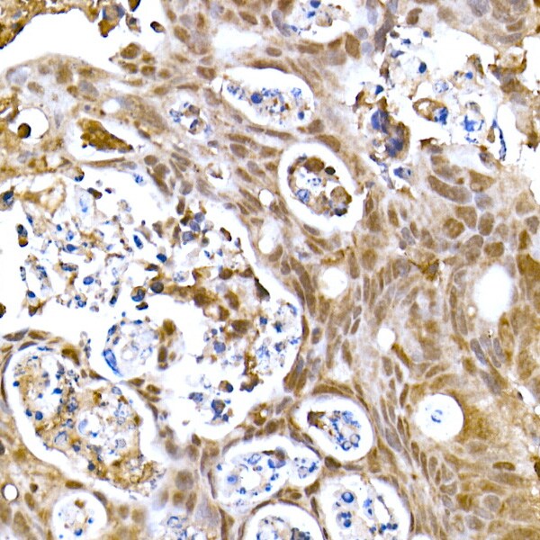 SOCS-1 Antibody (5T6Z10)