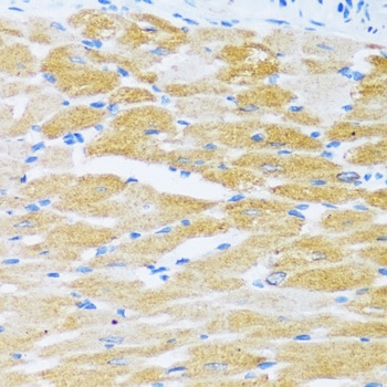 SERCA2 ATPase Antibody