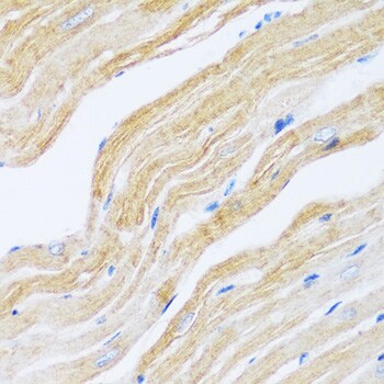 SERCA2 ATPase Antibody