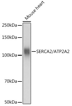 SERCA2 ATPase Antibody