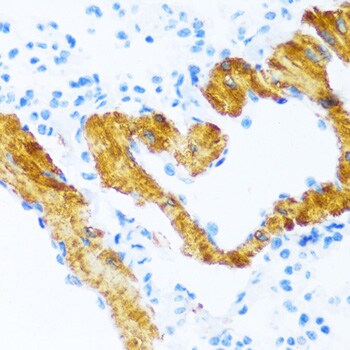 SERCA2 ATPase Antibody