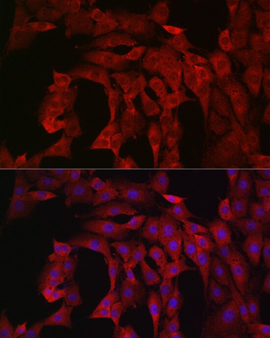 PIK3CA Antibody