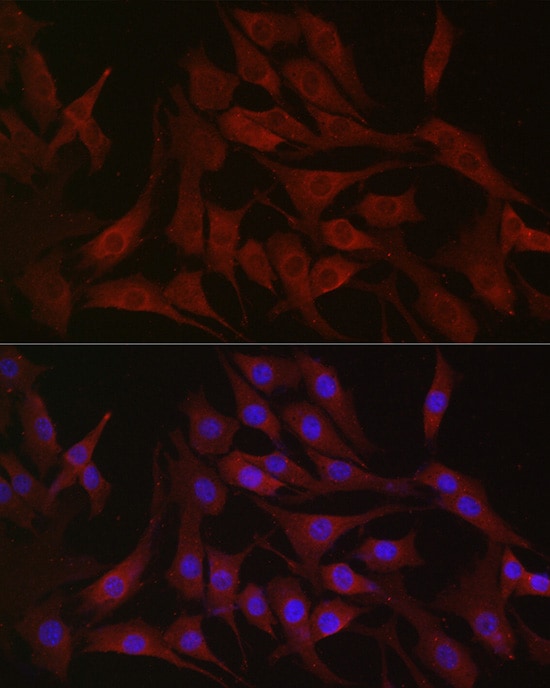PIK3CA Antibody