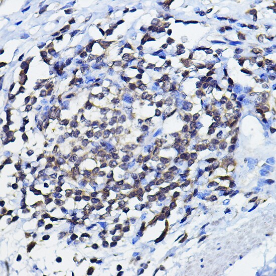 p73 Antibody