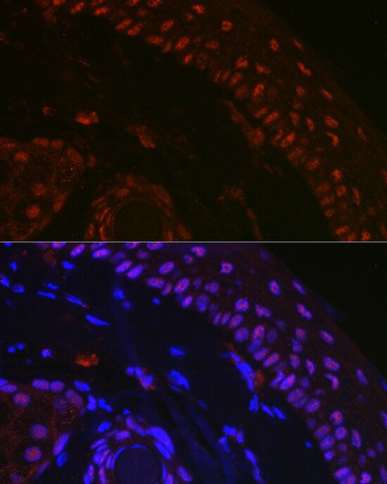 p73 Antibody