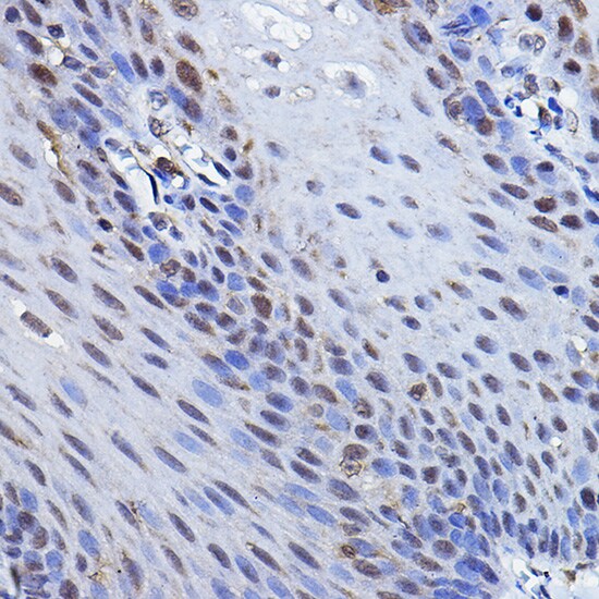 p73 Antibody