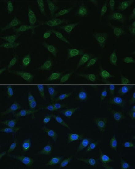 NUP98 Antibody