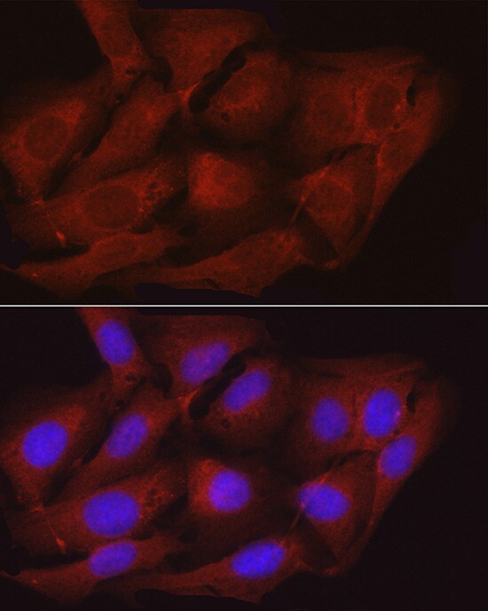 Myosin Phosphatase Antibody