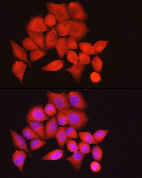 Myosin Phosphatase Antibody