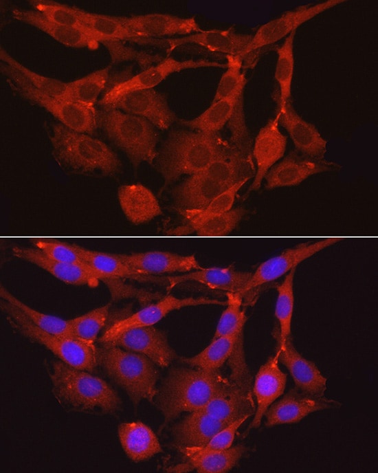 Myosin Phosphatase Antibody