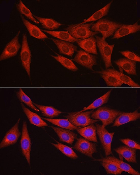 Myosin Phosphatase Antibody