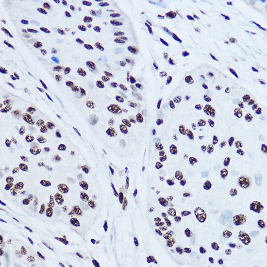 SSB Antibody