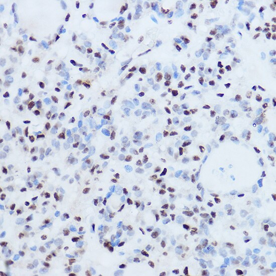 SSB Antibody