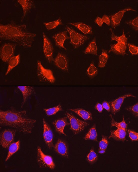 ATG13 Antibody