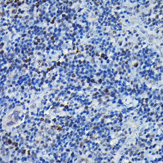 CEBP Beta Antibody