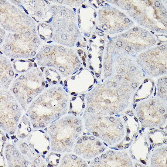 CEBP Beta Antibody