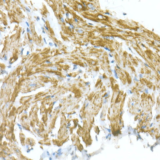 VDAC1 Antibody