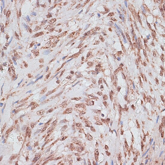 RPA70 Antibody