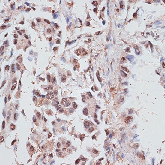 RPA70 Antibody