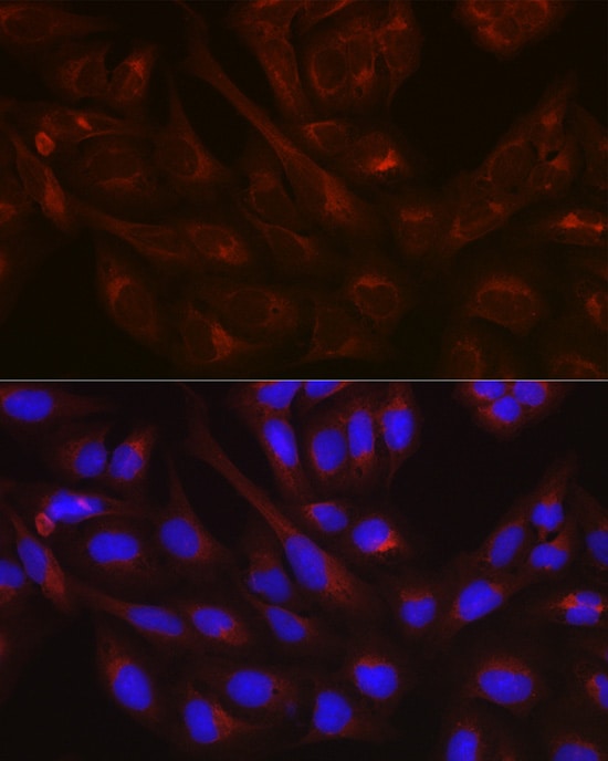 NSF Antibody