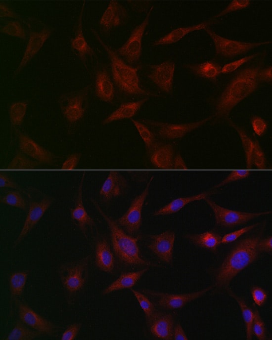 NSF Antibody