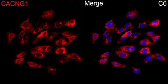 CACNG1 Antibody