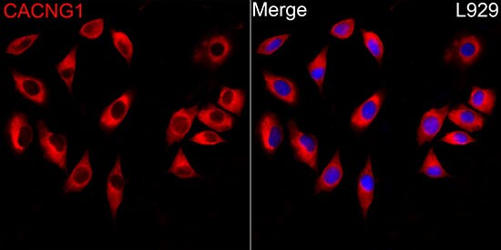 CACNG1 Antibody