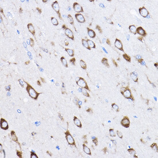 RPL8 Antibody