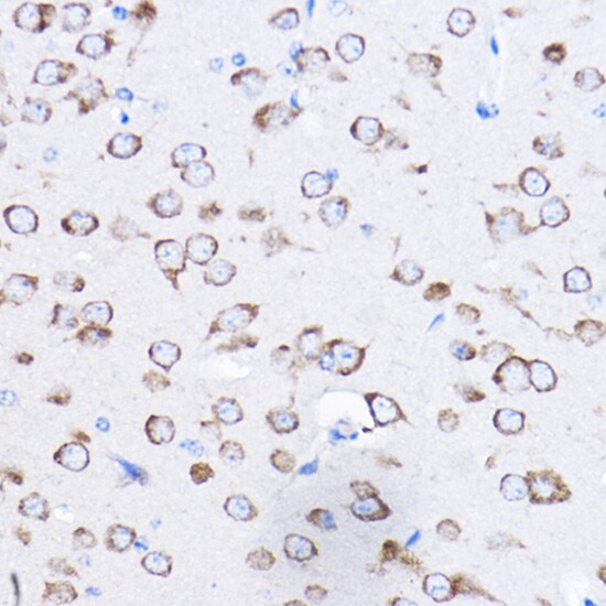 RPL8 Antibody