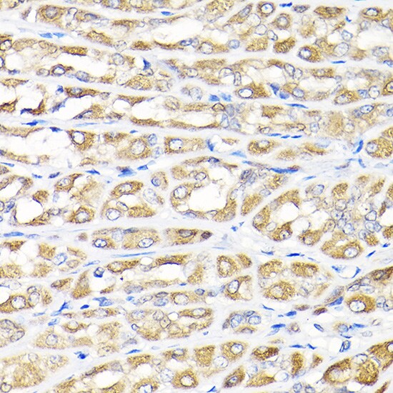 IKBKAP Antibody