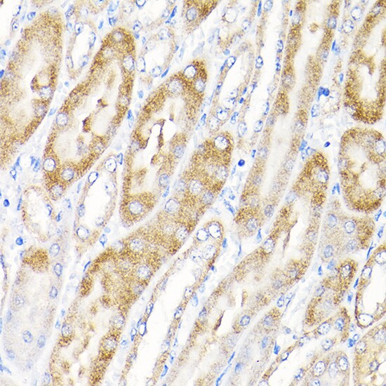IKBKAP Antibody