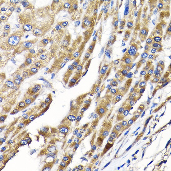 IKBKAP Antibody