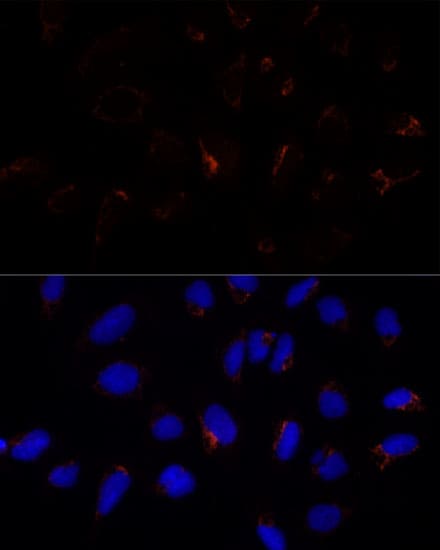 ETHE1 Antibody