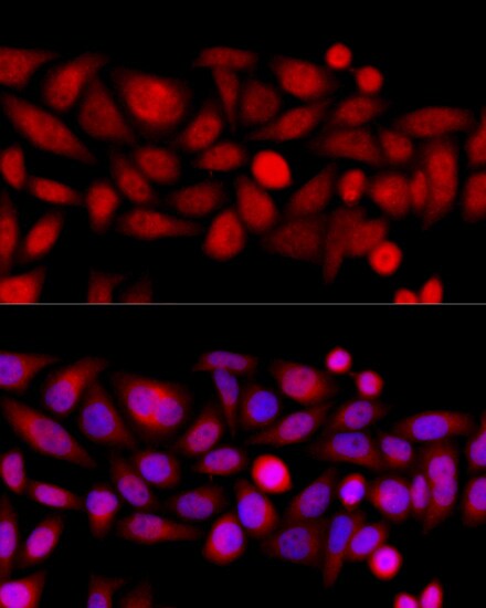 Kif4A Antibody