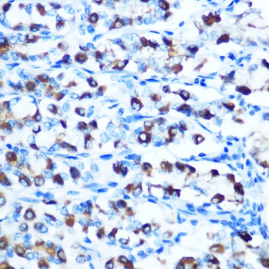 NRAMP2/SLC11A2/DMT1 Antibody