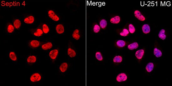 Septin-4 Antibody