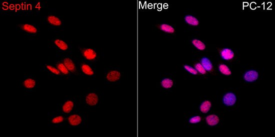 Septin-4 Antibody