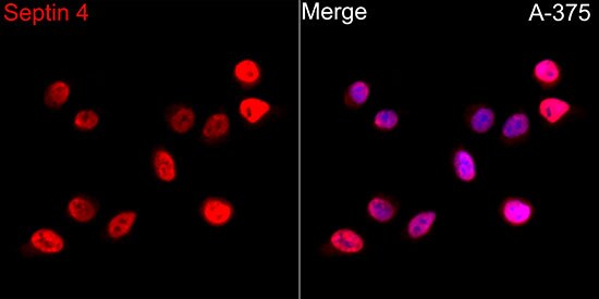 Septin-4 Antibody