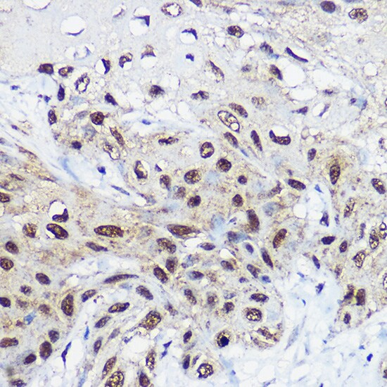 SMARCA1 Antibody